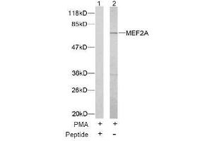Image no. 1 for anti-Myocyte Enhancer Factor 2A (MEF2A) (Thr312) antibody (ABIN197165) (MEF2A antibody  (Thr312))