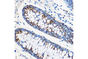 Immunohistochemistry (IHC) image for anti-Activating Transcription Factor 6 (ATF6) (AA 1-190) antibody (ABIN1512605)