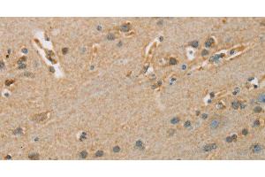 Immunohistochemistry of paraffin-embedded Human brain tissue using ARSA Polyclonal Antibody at dilution 1:50 (Arylsulfatase A antibody)