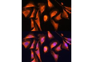 Immunofluorescence analysis of U-2 OS cells using R antibody (ABIN6128592, ABIN6146556, ABIN6146557 and ABIN6215667) at dilution of 1:100. (RAB21 antibody  (AA 1-225))