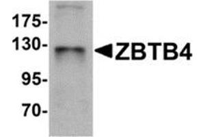 Western blot analysis of ZBTB4 in SK-N-SH cell lysate with ZBTB4 antibody at 1 μg/ml.