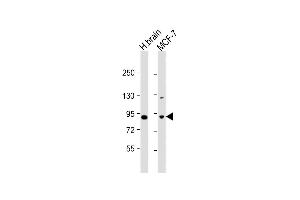 All lanes : Anti-JIP1 Antibody (C-term) at 1:1000 dilution Lane 1: human brain lysate Lane 2: MCF-7 whole cell lysate Lysates/proteins at 20 μg per lane. (MAPK8IP1 antibody  (C-Term))