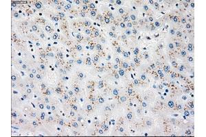 Immunohistochemical staining of paraffin-embedded liver tissue using anti-PLK1mouse monoclonal antibody. (PLK1 antibody)
