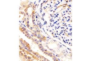 Antibody staining USP2 in human kidney tissue sections by Immunohistochemistry (IHC-P - paraformaldehyde-fixed, paraffin-embedded sections). (USP2 antibody  (C-Term))