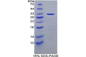 SDS-PAGE analysis of Mouse Stratifin Protein. (14-3-3 sigma/SFN Protein)