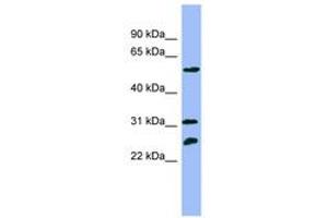 Image no. 1 for anti-Proteasome (Prosome, Macropain) 26S Subunit, ATPase, 4 (PSMC4) (N-Term) antibody (ABIN6741893) (PSMC4 antibody  (N-Term))