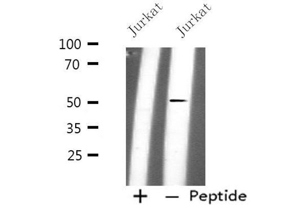 Phospholipase D4 antibody  (C-Term)