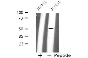 Western blot analysis of extracts from Jurkat cells, using PLD4 antibody. (Phospholipase D4 antibody  (C-Term))