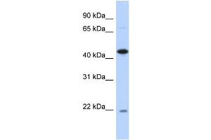 WB Suggested Anti-NOB1 Antibody Titration: 0. (NOB1 antibody  (N-Term))