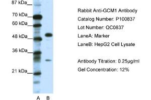 WB Suggested Anti-GCM1  Antibody Titration: 0. (GCM1 antibody  (C-Term))