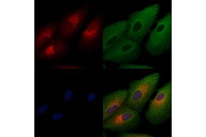 ABIN6257141 and ABIN6274489 staining  cells by IF/ICC. (DUSP9 antibody  (Internal Region))