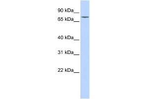 WB Suggested Anti-GALC Antibody Titration:  0. (GALC antibody  (Middle Region))
