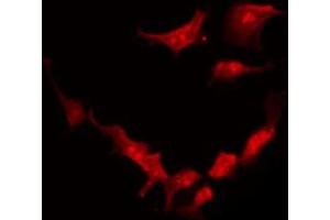ABIN6273921 staining HeLa by IF/ICC. (FZD2 antibody  (Internal Region))