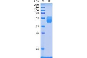 Human PSCA Protein, hFc Tag on SDS-PAGE under reducing condition.