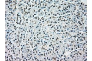 Immunohistochemical staining of paraffin-embedded colon tissue using anti-BRAFmouse monoclonal antibody. (BRAF antibody)