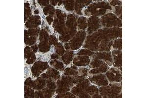 Immunohistochemical staining of human stomach with ABHD2 polyclonal antibody  shows strong cytoplasmic positivity in glandular cells at 1:10-1:20 dilution.