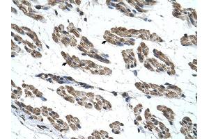 RNF40 antibody was used for immunohistochemistry at a concentration of 4-8 ug/ml to stain Skeletal muscle cells (arrows) in Human Muscle. (RNF40 antibody  (C-Term))