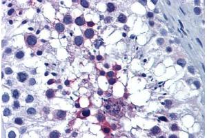 Human Testis: Formalin-Fixed, Paraffin-Embedded (FFPE) (ERP44 antibody  (AA 30-407))