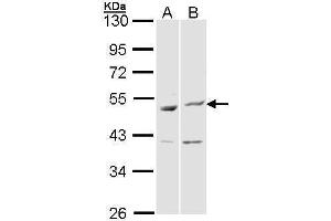 WB Image Sample (30 ug of whole cell lysate) A: Hela B: Molt-4 , 10% SDS PAGE antibody diluted at 1:1000 (BAG5 antibody)
