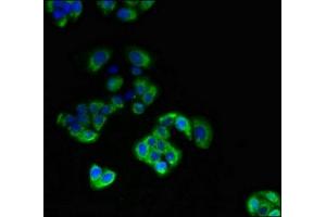 Immunofluorescent analysis of PC-3 cells using ABIN7172188 at dilution of 1:100 and Alexa Fluor 488-congugated AffiniPure Goat Anti-Rabbit IgG(H+L) (DIO3 antibody  (AA 50-115))