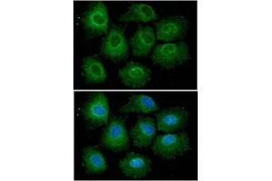 Immunofluorescent staining of Hep3B cell line with antibody. (VHL antibody  (AA 1-154))