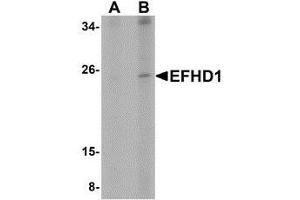 Western blot analysis of EFHD1 in human spleen tissue lysate with AP30309PU-N EFHD1 antibody at (A) 2 and (B) 4 μg/ml.