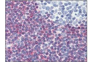 Immunohistochemistry (IHC) image for anti-Programmed Cell Death 4 (PDCD4) (AA 1-469), (N-Term) antibody (ABIN317548) (PDCD4 antibody  (N-Term))