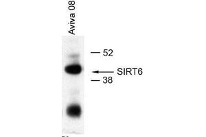 IP: 5 ul in 1ml of U2OS lysates (SIRT6 antibody  (Middle Region))