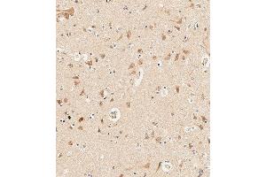 Immunohistochemistry (Paraffin-embedded Sections) (IHC (p)) image for anti-Protocadherin 9 (PCDH9) (AA 1018-1046), (C-Term) antibody (ABIN657109)