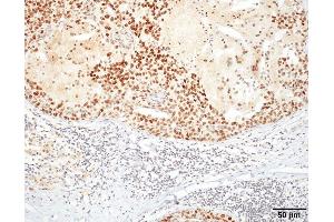 Immunohistochemistry analysis using Rat Anti-HSF1 Monoclonal Antibody, Clone 10H4 . (HSF1 antibody)