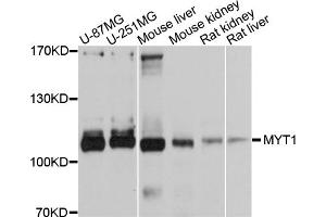 Western blot analysis of extracts of various cell lines, using MYT1 antibody (ABIN5998292) at 1/1000 dilution. (MYT1 antibody)