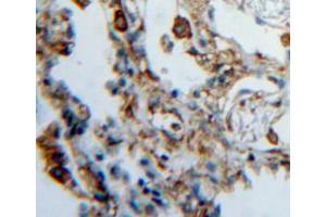 Used in DAB staining on fromalin fixed paraffin-embedded lung tissue (HPSE antibody  (AA 419-535))