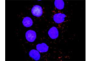 Proximity Ligation Analysis of protein-protein interactions between PXN and MAPK8. (JNK antibody  (AA 1-384))