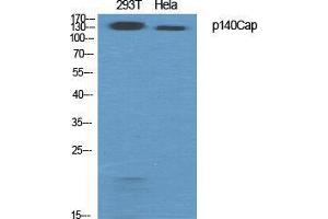 Western Blot (WB) analysis of specific cells using p140Cap Polyclonal Antibody. (SRCIN1 antibody  (Internal Region))