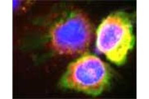 Confocal microscopy on isolated monocytes. (Myeloperoxidase antibody)
