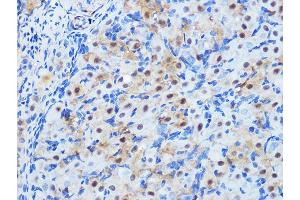 Immunohistochemistry of paraffin-embedded rat ovary using PP1 beta Rabbit mAb (ABIN1679819, ABIN3018859, ABIN3018860 and ABIN7101675) at dilution of 1:100 (40x lens).