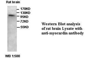 Image no. 1 for anti-Myocardin (MYOCD) antibody (ABIN791202) (Myocardin antibody)