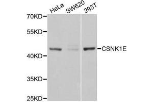 Western Blotting (WB) image for anti-Casein Kinase 1, epsilon (CSNK1E) antibody (ABIN1980191) (CK1 epsilon antibody)