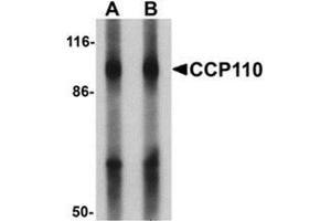 Western blot analysis of CCP110 in human colon tissue lysate with CCP110 Antibody  at (A) 1 and (B) 2 ug/mL.