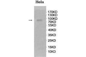 Western blot analysis of fetal brain lysate using GnT-V Antibody at a dilution of 1/500. (MGAT5 antibody  (C-Term))