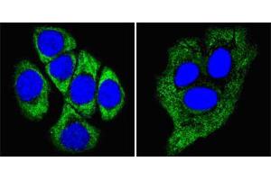 Confocal immunofluorescence analysis of methanol-fixed ECA109 cells (left) and HepG2 cells (right) using CK8 mouse mAb (green), showing cytoplasmic localization. (KRT8 antibody  (AA 391-483))