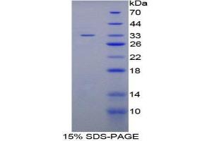 SDS-PAGE (SDS) image for Inter alpha Globulin Inhibitor H4 (ITIH4) (AA 683-928) protein (His tag) (ABIN1170715)