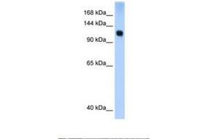 Image no. 1 for anti-SWI/SNF Related, Matrix Associated, Actin Dependent Regulator of Chromatin, Subfamily A, Member 5 (SMARCA5) (AA 51-100) antibody (ABIN6737635) (SMARCA5 antibody  (AA 51-100))