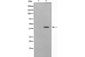 Western blot analysis on 293 cell lysate using CBX6 Antibody,The lane on the left is treated with the antigen-specific peptide.