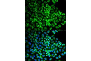 Immunofluorescence analysis of U2OS cells using GRIA3 antibody. (Glutamate Receptor 3 antibody)