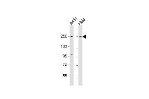 All lanes : Anti-MYH9 Antibody (N-term ) at 1:1000 dilution Lane 1: A431 whole cell lysate Lane 2: Hela whole cell lysate Lysates/proteins at 20 μg per lane.