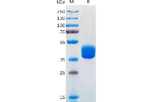SDS-PAGE (SDS) image for Adenosine A2a Receptor (ADORA2A) (AA 1-7) protein (Fc Tag) (ABIN7092676)