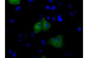 Anti-BTK mouse monoclonal antibody (ABIN2452830) immunofluorescent staining of COS7 cells transiently transfected by pCMV6-ENTRY BTK (RC211582). (BTK antibody)