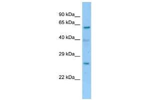 WB Suggested Anti-2700060E02Rik Antibody   Titration: 1. (RIKEN CDNA 2700060E02 Gene (2700060E02RIK) (C-Term) antibody)