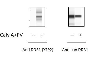 Jurkat cells were treated with Calyculin A and Pervanadate. (DDR1 ELISA Kit)